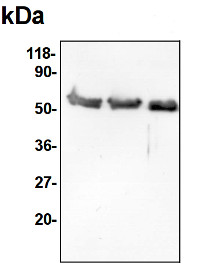 SHMT | Serine hydroxymethyltransferase in the group Antibodies Plant/Algal  / Mitochondria | Respiration at Agrisera AB (Antibodies for research) (AS05 075)